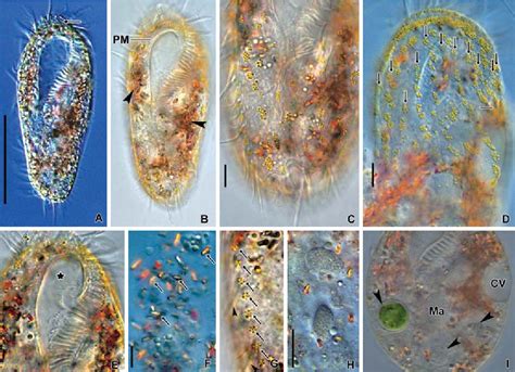  Oxytricha: Découvre ce Ciliophora aux multiples noyaux qui danse avec grâce !